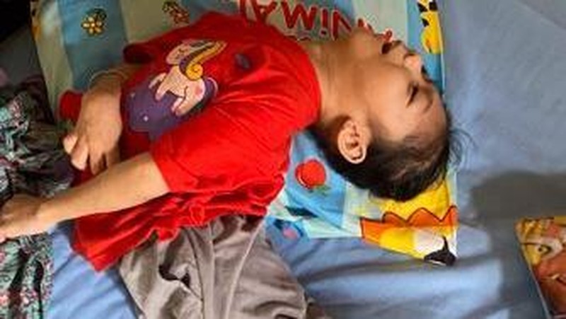 Kisah Pilu Andini, Anak Pencari Ikan yang Alami Cerebral Palsy