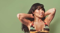 7 Foto Before-After Artis Korban Filler Abal-abal, Wajah Rusak Tak Dikenali