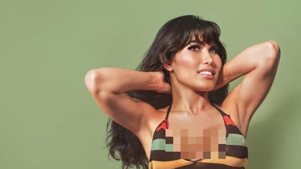 7 Foto Before-After Artis Korban Filler Abal-abal, Wajah Rusak Tak Dikenali