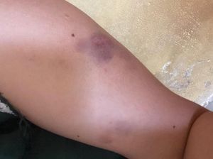 Kasus Polisi Aniaya Pacar gegara Tak Dipinjamkan HP di Gorut Berakhir Damai Kasus Polisi Aniaya Pacar gegara Tak Dipinjamkan HP di Gorut Berakhir Damai