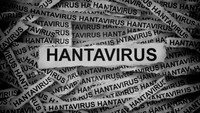 IDAI Imbau Tak Khawatir Soal Hantavirus, Masalah Difteri-Campak Lebih Darurat