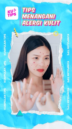 Video KuTips: 2 Langkah Awal Penanganan Alergi di Kulit, Harus Apa? 