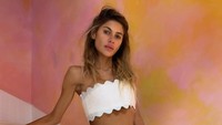 7 Potret Beauty Influencer Meninggal Lawan Penyakit Anoreksia, BB Hanya 23 Kg
