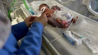 Potret Pilu Bayi di Gaza Malnutrisi, Tubuhnya Kurus Kering Kekurangan Gizi