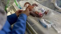 Potret Pilu Bayi di Gaza Malnutrisi, Tubuhnya Kurus Kering Kekurangan Gizi