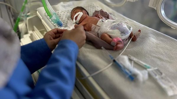 Potret Pilu Bayi di Gaza Malnutrisi, Tubuhnya Kurus Kering Kekurangan Gizi
