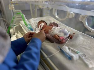 Potret Pilu Bayi di Gaza Malnutrisi, Tubuhnya Kurus Kering Kekurangan Gizi Potret Pilu Bayi di Gaza Malnutrisi, Tubuhnya Kurus Kering Kekurangan Gizi