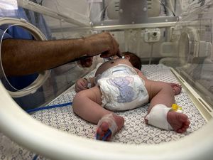 Israel Masih Blokir Bantuan, Bayi-bayi di Gaza Sekarat Menunggu Ajal Israel Masih Blokir Bantuan, Bayi-bayi di Gaza Sekarat Menunggu Ajal