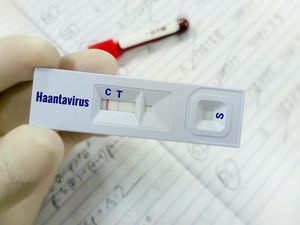 Apa Itu Virus Hanta yang Menyebar di Indonesia? Ini Gejalanya Apa Itu Virus Hanta yang Menyebar di Indonesia? Ini Gejalanya