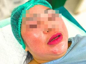 Ibu-Anak di Tarakan Jadi Korban Layangan, Biaya Pengobatan Capai Rp 3 Juta Ibu-Anak di Tarakan Jadi Korban Layangan, Biaya Pengobatan Capai Rp 3 Juta