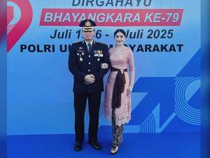 Uut Permatasari Ungkap Reaksi Suami Usai 3 Bulan Oplas