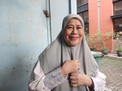 Dewi Yull Ungkap Penyebab Mata Kanan Tak Bisa Melihat