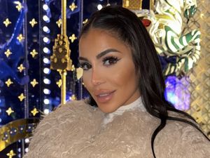 Posting Wajah Berdarah, Beauty Influencer Ceritakan Diserang Perampok