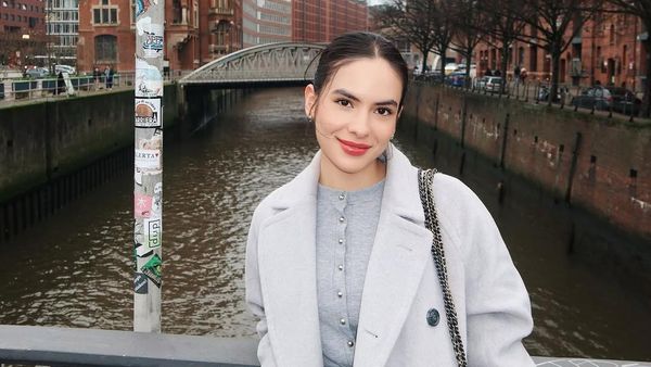 Steffi Zamora Akui Dulu Bule Ireng, Sekarang Putih karena Suntik?