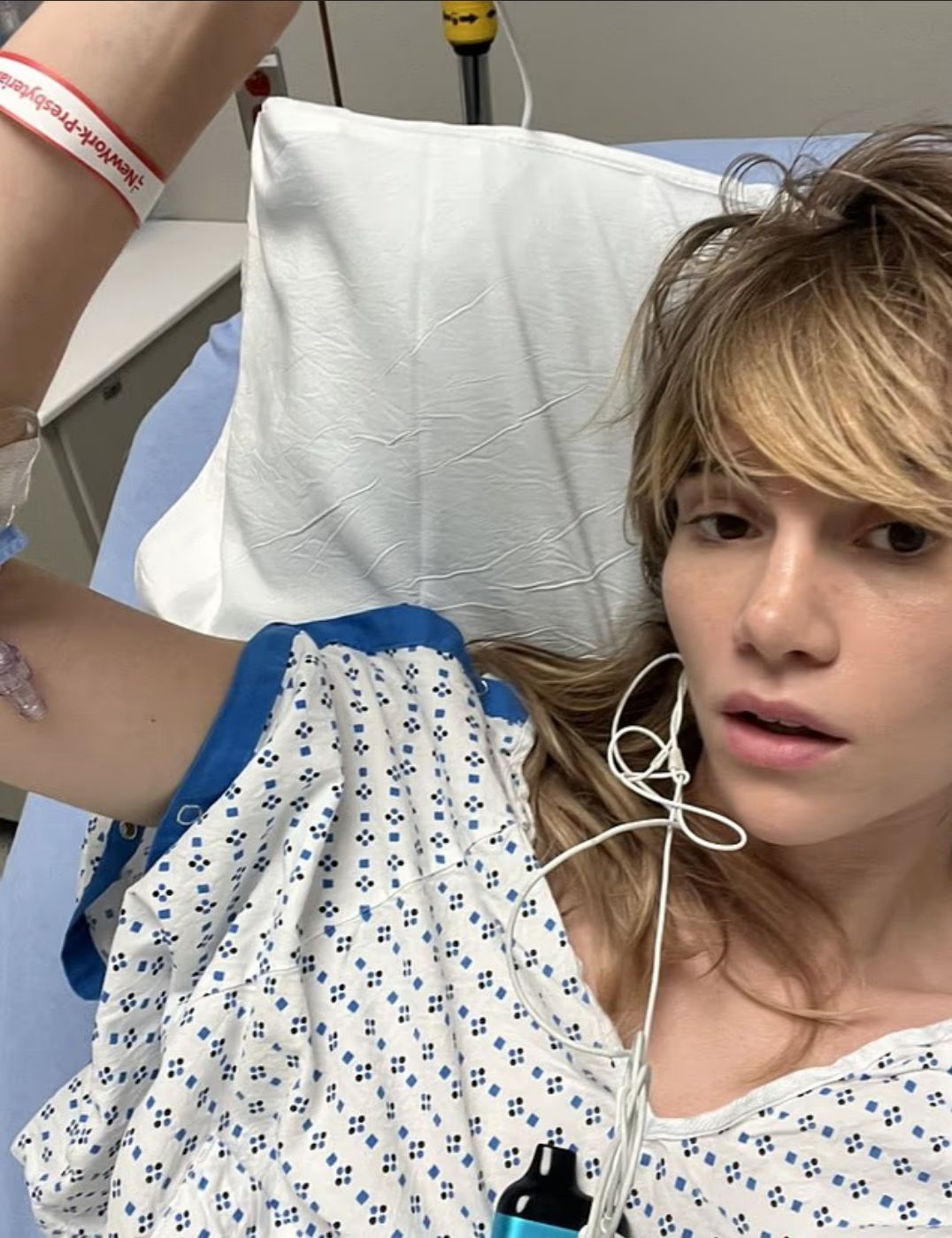 Suki Waterhouse saat dirawat di rumah sakit karena hernia.