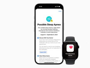 Apple Watch Kini Bisa Deteksi Sleep Apnea, Ini Cara Kerjanya Apple Watch Kini Bisa Deteksi Sleep Apnea, Ini Cara Kerjanya