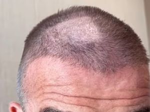 Salah Potong Rambut, David Beckham jadi Pitak Salah Potong Rambut, David Beckham jadi Pitak