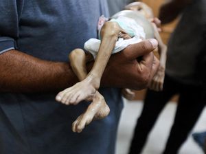 Bencana Kelaparan di Gaza Kian Parah, Dokter Pingsan karena Kurang Gizi