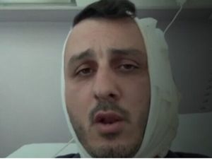 Liburan di Yunani, Telinga Turis Israel Robek Digigit Orang