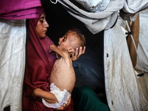 Miris! Kelaparan Membuat Anak-anak Gaza Tak Kuat Lagi Menangis Miris! Kelaparan Membuat Anak-anak Gaza Tak Kuat Lagi Menangis