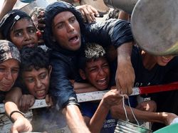 Wanita Muda Palestina Idap Malnutrisi Akut, Meninggal saat Perawatan di Italia