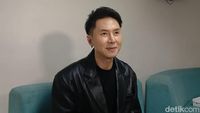 Perubahan Wajah Rafael Tan Sebelum dan Sesudah Operasi di Korea Selatan
