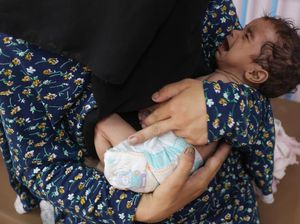 WHO: 99 Orang di Gaza Alami Malnutrisi, 29 Masih Balita WHO: 99 Orang di Gaza Alami Malnutrisi, 29 Masih Balita