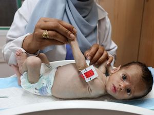 Tubuh Ringkih Bayi Gaza, Lengan Selebar Jari Orang Dewasa Tubuh Ringkih Bayi Gaza, Lengan Selebar Jari Orang Dewasa