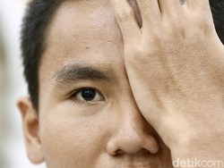 13,8 Juta Anak Ikut CKG Sekolah, Ini Masalah Kesehatan yang Banyak Ditemukan 13,8 Juta Anak Ikut CKG Sekolah, Ini Masalah Kesehatan yang Banyak Ditemukan