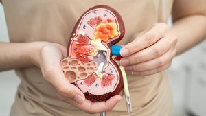 Hampir 1,5 Juta Orang Meninggal Akibat Penyakit Ginjal, Jangan Abaikan Gejala Ini