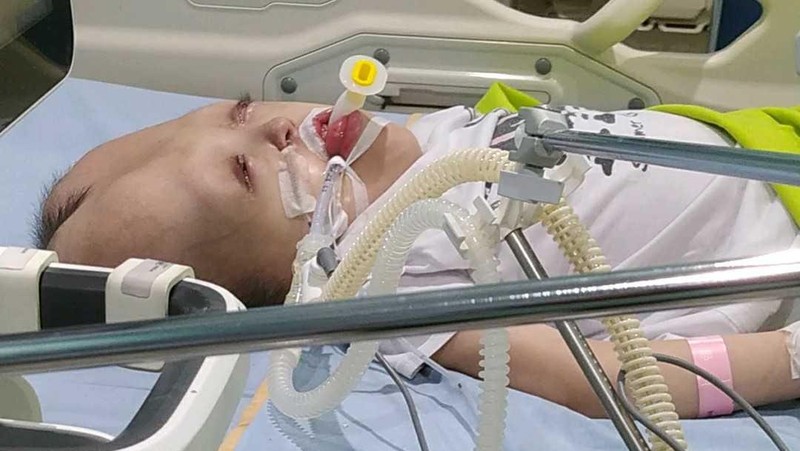 Kisah Dhafita yang Berjuang Lawan Hidrosefalus, Epilepsi hingga Cerebral Palsy