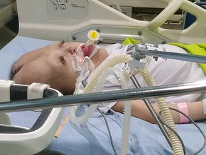 Kisah Dhafita yang Berjuang Lawan Hidrosefalus, Epilepsi hingga Cerebral Palsy