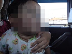 Kasus Anak 1 Tahun Luka Saat di Daycare Surabaya Diselidiki Polda Jatim
