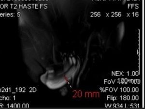 Krek! Dokter Tangani Kasus Mr P Patah saat Bercinta, Berujung Jalani Operasi Krek! Dokter Tangani Kasus Mr P Patah saat Bercinta, Berujung Jalani Operasi