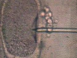 Bayi-bayi di Inggris Lahir dari 3 Orangtua