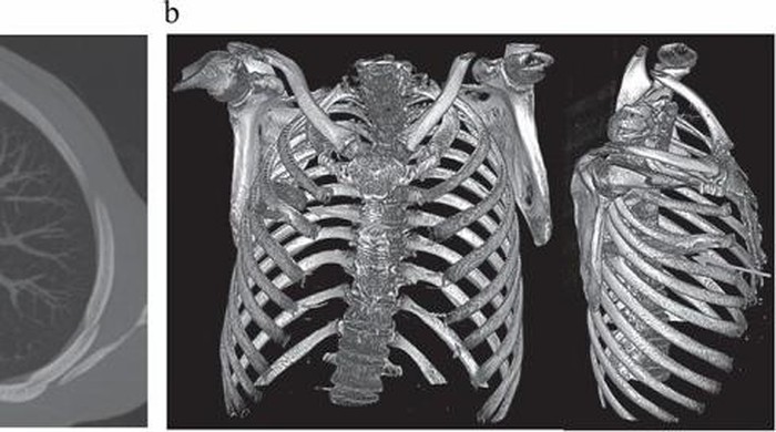 Pisau nyangkut di payudara pria Pisau nyangkut di payudara pria