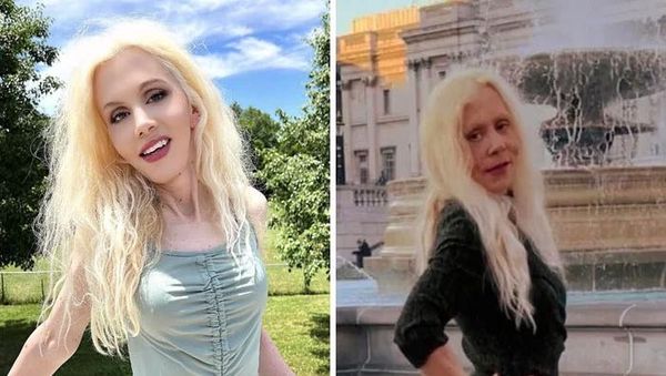 Foto Editan Medsos Kebablasan, Bikin Kaget dan Geleng-geleng