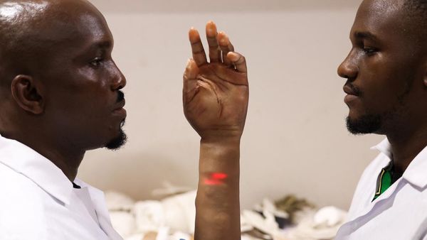 Keren, Lengan Bionik dari Nigeria Seperti Kulit Manusia