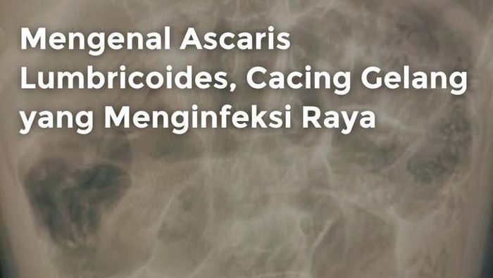 Video: Mengenal Ascaris Lumbricoides, Cacing Gelang yang Menginfeksi Raya