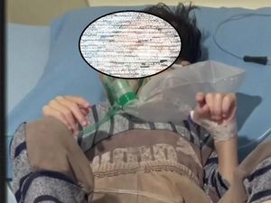 Miris! Bocah 4 Tahun di Palembang Alami Gizi Buruk, Ortu Susah Urus KIS Miris! Bocah 4 Tahun di Palembang Alami Gizi Buruk, Ortu Susah Urus KIS