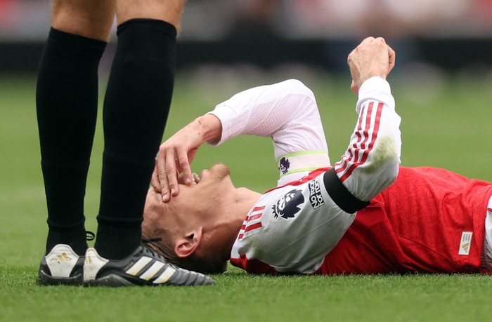 Soccer Football - Premier League - Arsenal v Leeds United - Emirates Stadium, London, Britain - August 23, 2025 Arsenal's Martin Odegaard reacts after sustaining an injury REUTERS/David Klein EDITORIAL USE ONLY. NO USE WITH UNAUTHORIZED AUDIO, VIDEO, DATA, FIXTURE LISTS, CLUB/LEAGUE LOGOS OR 'LIVE' SERVICES. ONLINE IN-MATCH USE LIMITED TO 120 IMAGES, NO VIDEO EMULATION. NO USE IN BETTING, GAMES OR SINGLE CLUB/LEAGUE/PLAYER PUBLICATIONS. PLEASE CONTACT YOUR ACCOUNT REPRESENTATIVE FOR FURTHER DETAILS..