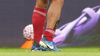 Pul sepatu Gordon meninggalkan bekas guratan di betis Van Dijk. Foto: Getty Images/George Wood  