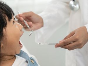 90 Persen Anak RI Alami Karies Gigi, Kenali Pemicu dan Cara Mengatasinya 90 Persen Anak RI Alami Karies Gigi, Kenali Pemicu dan Cara Mengatasinya