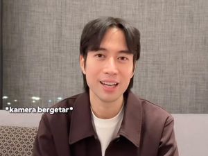 Vidi Aldiano Buktikan Gak Sesakit Itu dan Tanpa Wig: Im Fine!