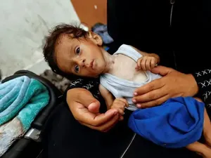 Memilukan! Anak-anak Gaza yang Kelaparan Terlalu Lemah untuk Menangis