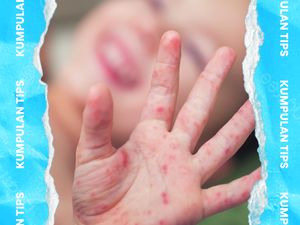 Video KuTips: Terapi Campak pada Anak, IDAI Ingatkan Isolasi Diri Video KuTips: Terapi Campak pada Anak, IDAI Ingatkan Isolasi Diri