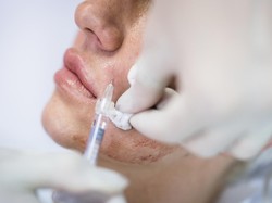 Skin Booster vs Collagen Stimulator, Mana yang Tepat untuk Kulitmu?