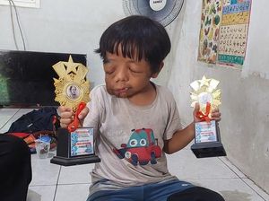 Kisah Pilu Ilyas, Bocah Penderita Tumor Getah Bening yang Sering Dirundung