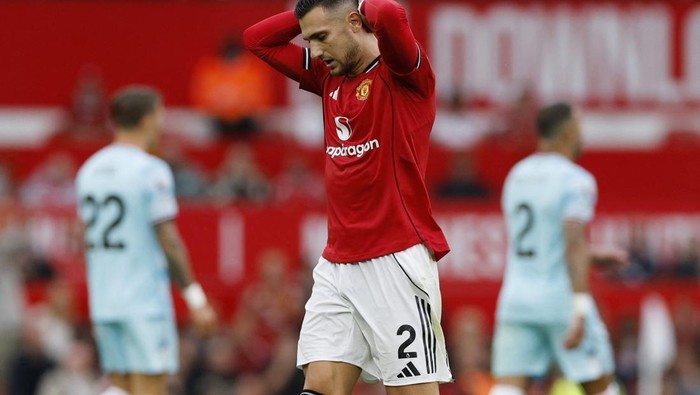 Soccer Football - Premier League - Manchester United v Burnley - Old Trafford, Manchester, Britain - August 30, 2025 Manchester Uniteds Diogo Dalot reacts Action Images via Reuters/Jason Cairnduff EDITORIAL USE ONLY. NO USE WITH UNAUTHORIZED AUDIO, VIDEO, DATA, FIXTURE LISTS, CLUB/LEAGUE LOGOS OR LIVE SERVICES. ONLINE IN-MATCH USE LIMITED TO 120 IMAGES, NO VIDEO EMULATION. NO USE IN BETTING, GAMES OR SINGLE CLUB/LEAGUE/PLAYER PUBLICATIONS. PLEASE CONTACT YOUR ACCOUNT REPRESENTATIVE FOR FURTHER DETAILS..