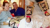 Foto: Perubahan Wanita AS usai Operasi Peninggi Badan, Dari 117 Cm ke 151 Cm